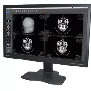 Medizinischer Befundmonitor für Mammografie 31,5" 8 MP MSLMD16